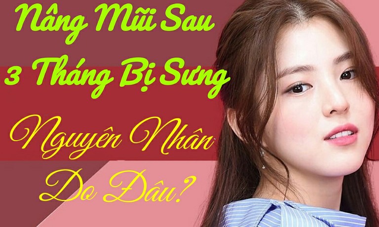 nang-mui-sau-3-thang-bi-sung.jpg