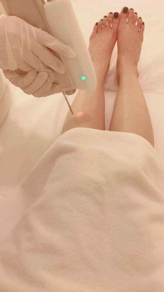 So sánh công nghệ triệt lông IPL và Laser, cái nào tốt hơn?